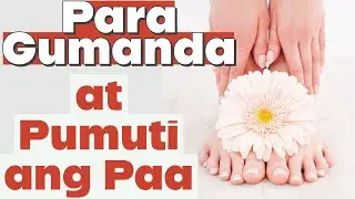 Para Gumanda ang Paa at Pumuti - Payo ni Doc Liza Ong