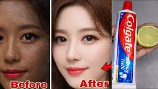 Colgate toothpaste for face whitening | Lemon and Colgate
