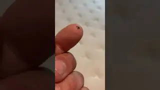 Definitely Bed Bugs