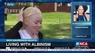 Skin Awareness Month | Dealing with prejudice