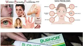 burnoff creme is also a beauty creme