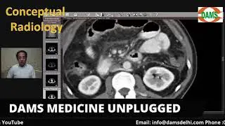 Radiology Case Discussion-Acute Pancreatitis