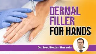 💉Role of Dermal Fillers in Hand Rejuvenation | ❇️ What Kind of Filler is Used For Hands? - RLC