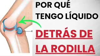 🦵 Por Qué Tenemos LÍQUIDO e INFLAMACIÓN Detrás De LA RODILLA y Cómo Solucionarlo