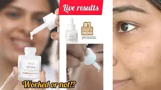 Vilvah Milk Drops review | Vilvah Milk drops review tamil | Glowing Skin Tips in Tamil 
