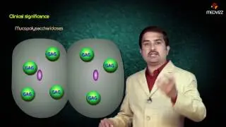 Metabolism of Amino sugars & mucopolysaccharidosis