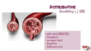 RANDOM FACTLET 006: Types of Shock