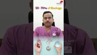 What Is Coronary Artery Bypass Surgery & How It Works | Kauvery Hospital Chennai | Tamil Shorts