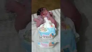 Почему ребёнок рождается с поднятыми ногами? 👶🦵