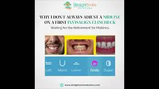Why I don't NORMALLY Adjust Midlines or use Elastics on a First Invisalign Clincheck