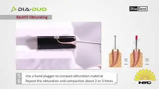 DIA DUO DIADENT cordless obturation system