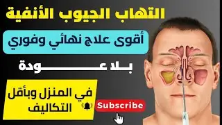 (حصري) - طريقة علاج التهاب الجيوب الأنفية وانسداد الأنف (بالحجامة) وبدون أدوية وبسرعة وبدون تكاليف
