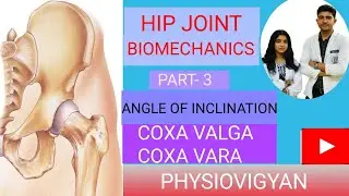 Angle of inclination ll Coxa vara & Coxa Valga in biomechanics