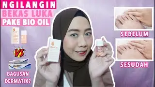 BEKAS LUKA HILANG PAKAI BIO OIL?? BAGUSAN MANA SAMA DERMATIX?? - REVIEW BIO OIL | NURULNUCAN