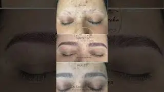 No Hair to Fuller #brow by Dr Sajesh #eyebrows #cosmetics #alopecia #microblading #usa #uk #dubai