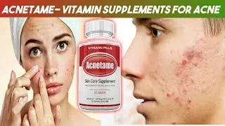 Acnetame- Vitamin Supplements for Acne Treatment, 60 Natural Pills