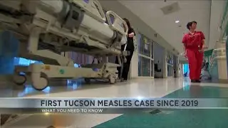 Pima County health director speaks on first Tucson measles case since 2019
