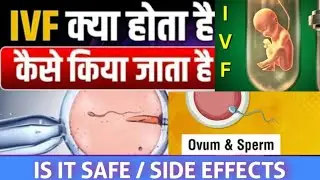 IVF Explained: The Step-by-Step Process of In Vitro Fertilization