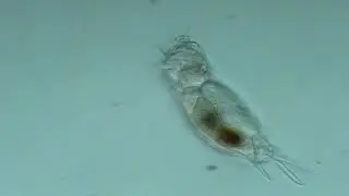 Rotifer: Mytilina