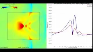 Shockwave Lithotripsy: Fluid-Solid Coupled Analysis (II)