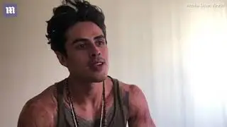 Male model recalls house fire that left him covered in scars
