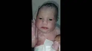 NEWBABAY TUCHNING Live Stream//newborn baby live//babies reaction live//baby nicu live// cutebaby