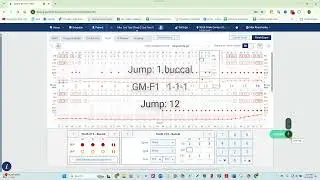 Voice Enabled Perio Charting & PHI Reporting for Dentrix Ascend with Denti AI Voice