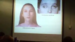 14. Rodrigo's Husson Neuroscience Lecture 14 (2012)