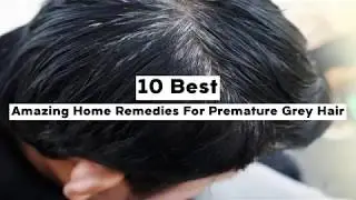 10 Amazing Home Remedies For Premature Grey Hair