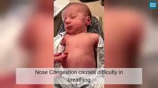 Mee Mee Soft Nozzle Nasal Aspirator | Treat Your Baby&rsquo;s Stuffy Nose