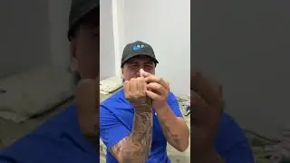 Anastesiolog0😱🔥How Funny Video ! Short Videos !😱🔥🤣 #top #trending #foryou #viral #shortvideo #comedy
