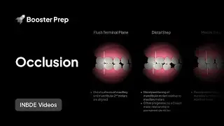 Prosthodontics | Occlusion & Picket Fence | INBDE, NDEB, ADAT