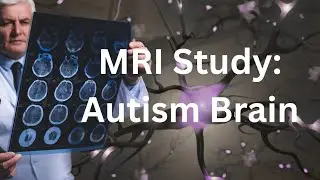 Autistic Brain vs Normal Brain | MRI Studies About Autism #autismawareness