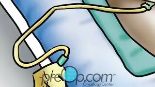 🩺 Essential Catheter Care Tips for Women! #CatheterCare #HealthTips PreOp&reg; Patient Education