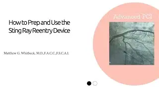 How to Prep and Use the Sting Ray Device for CTO PCI