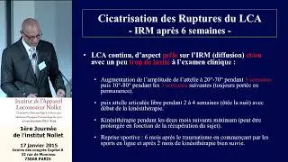 Docteur Jean Yves Van Den Steene   Traitement conservateur et cicatrisation des ruptures du LCA