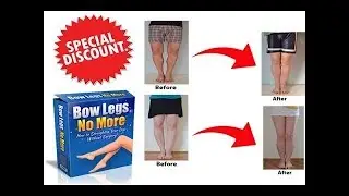 bow legs no more review - bow legs no more scam?