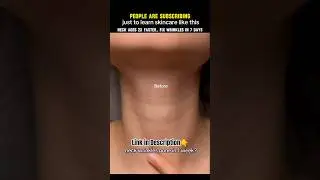 Neck ages 2x faster &mdash; fix wrinkles in 7 days #shorts #ytshorts #trending #skincareproducts