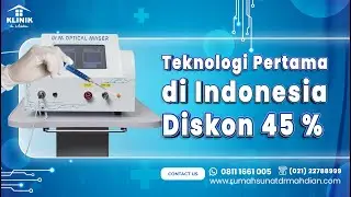 DISKON 45% METODE SUNAT LASER DENGAN dr. M OPTICAL MASER