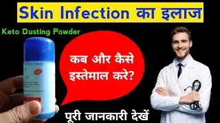 Keto Dusting Powder|Keto Dusting Powder uses in hindi|Fungal Infection Treatment