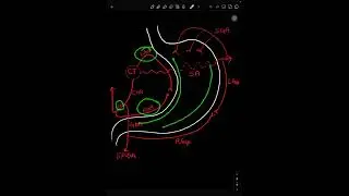 Stomach Blood Supply MCQ l Branch by Branch Trap