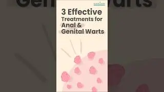 3 Best Treatments for Anal & Genital Warts &ndash; Expert Advice by Dr. Daniel Serrelta #healthtips #uae