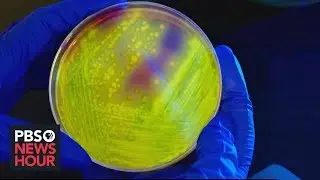 Why overuse of antibiotics is a massive, 'staggering' problem in health care