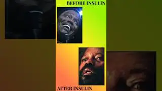 Before and after the insulin shot #comedy #film #movie #funny #memes