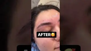 FIRST TIME GETTING THREADED 😍#eyebrows #browtutorial #eyebrowthreading #browshape #naturalbeauty