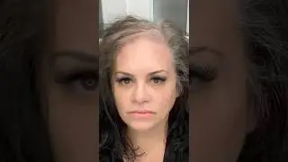 2 days after using Boldify products what really happened