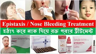 Nose Bleeding Treatment | Epistaxis Treatment | Bong Pharma