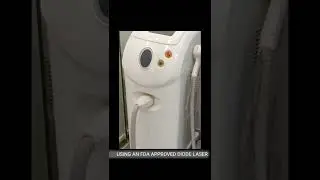 LASER HAIR REDUCTION PROCESS in 15 seconds #shorts #youtubeshorts