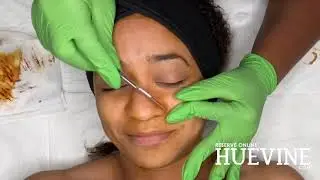 Professional Microneedling + Dermaplaning (Session & Results) | HueVine