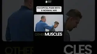 Targeting Occipital Neuralgia at the Source